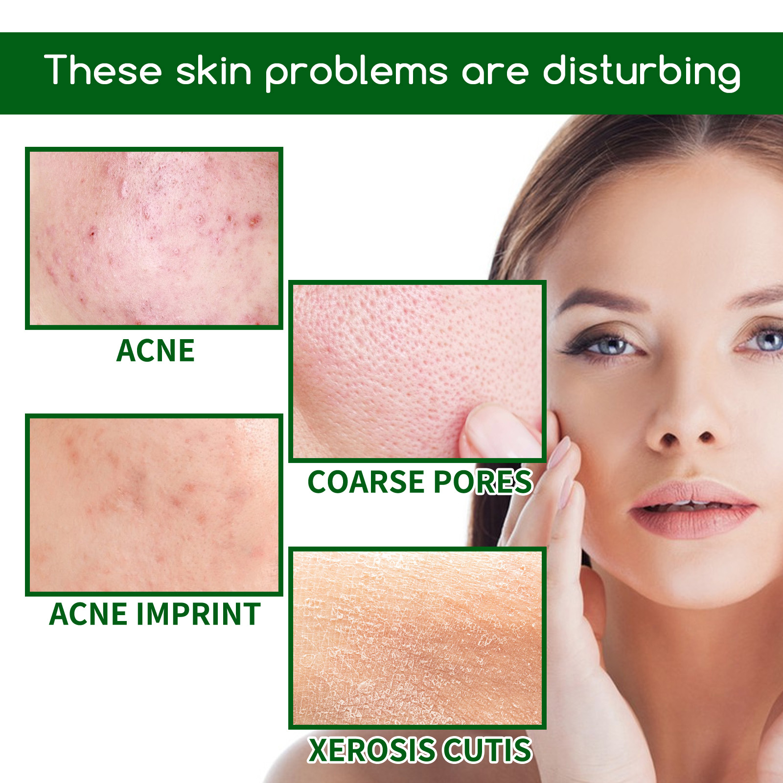 Salicylic Acid Anti Acn-e Face - Skincare Salicylic Acid のレビューと価格