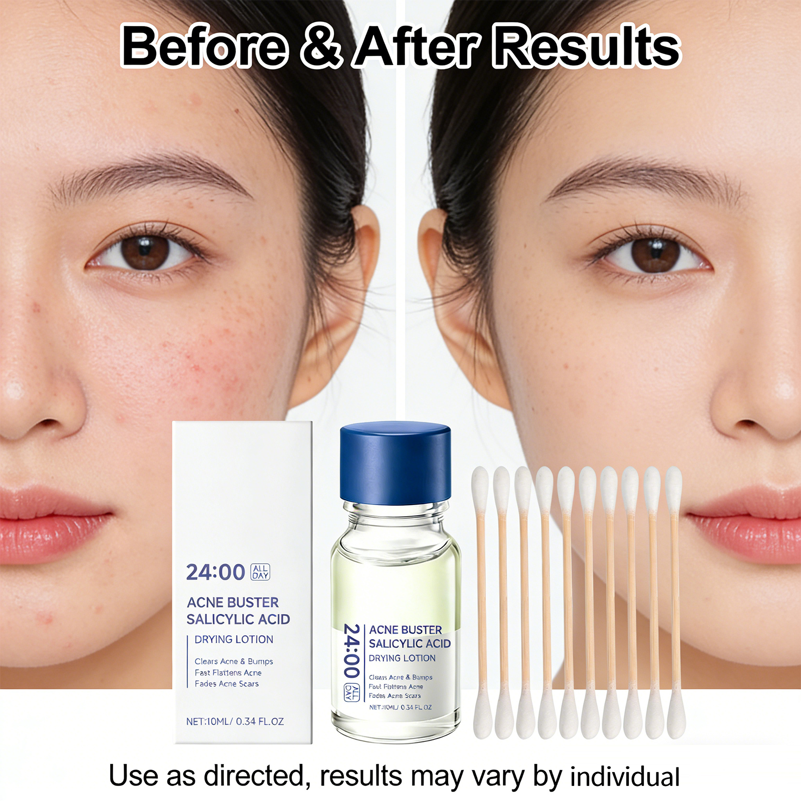 Salicylic Acid Drying Lotion A - Skincare Salicylic Acid のレビューと価格