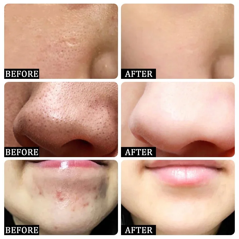Salicylic Acid Pore Clearing C - Skincare Salicylic Acid のレビューと価格
