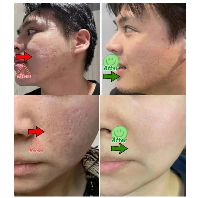 Salicylic Acid Pore Clearing C - Skincare Salicylic Acid のレビューと価格