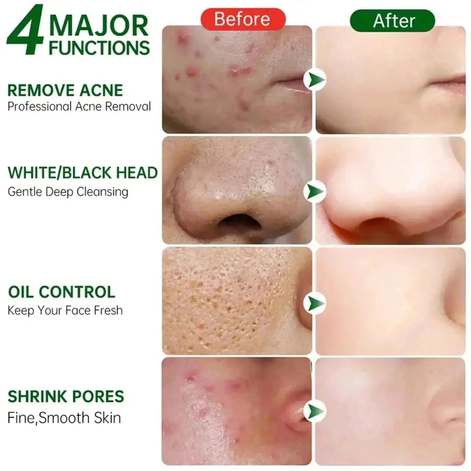 Salicylic Acid Pore Clearing C - Skincare Salicylic Acid のレビューと価格