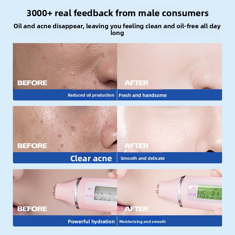 RUYI Men Skin Care Set Salicyl - Skincare Salicylic Acid のレビューと価格