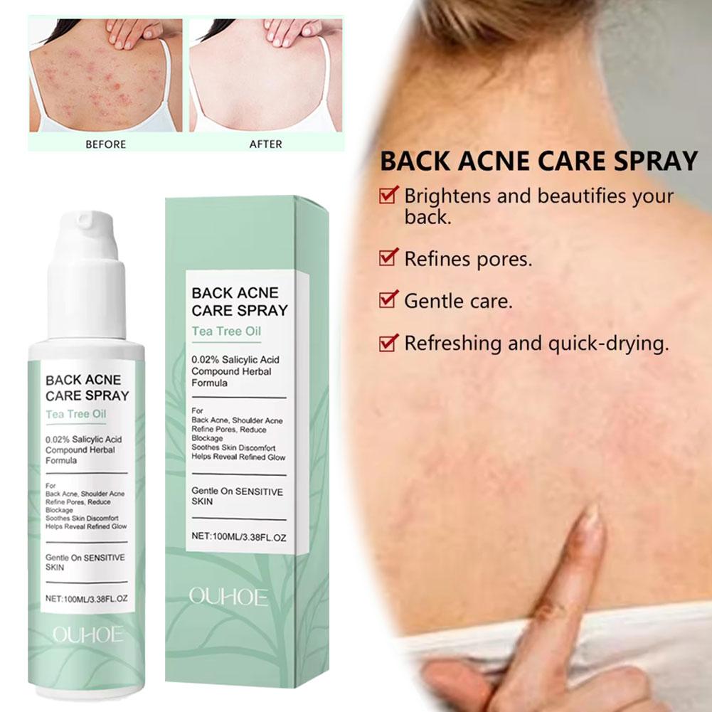 Salicylic Acid Back Acne Spray - Skincare Salicylic Acid のレビューと価格