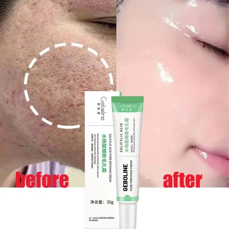 Salicylic Acid Pore Shrinking  - Skincare Salicylic Acid のレビューと価格