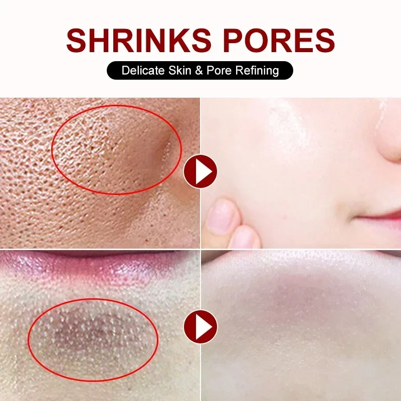 Salicylic Acid Pore Shrinking  - Skincare Salicylic Acid のレビューと価格