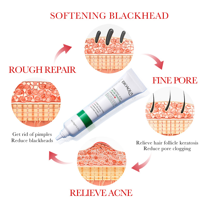 Salicylic Acid Shrink Pore Cre - Skincare Salicylic Acid のレビューと価格