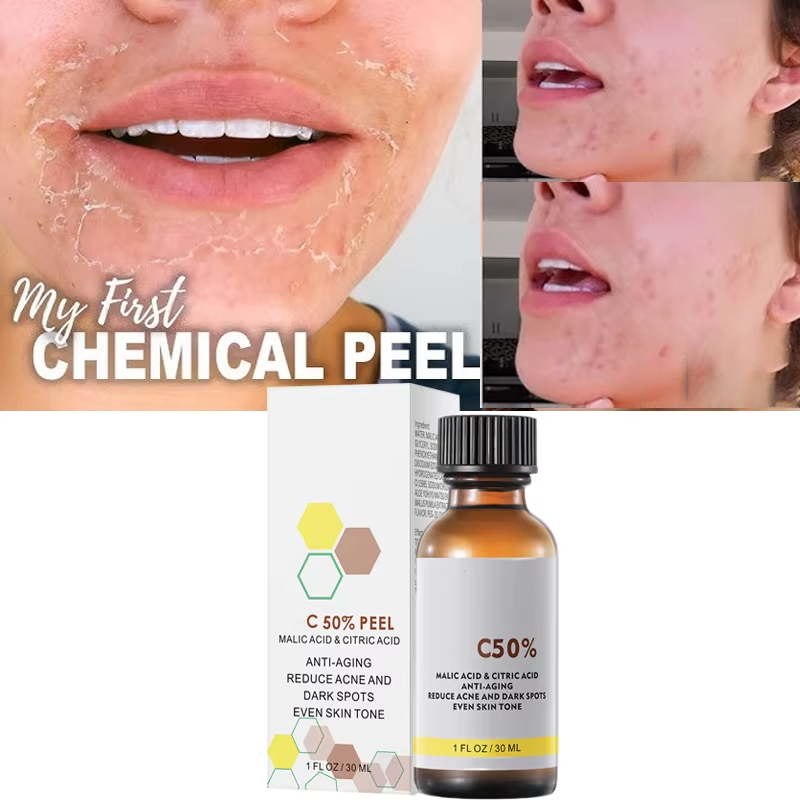 With Malic Acid And Citric Aci - Skincare Salicylic Acid のレビューと価格